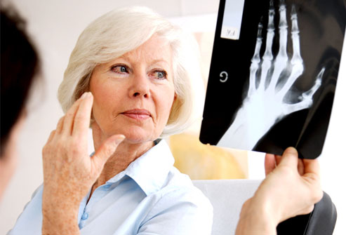 Sintomas da artrite