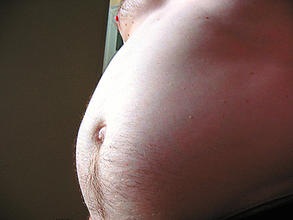 A obesidade abdominal e o tamanho da cintura na saúde