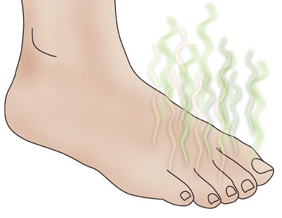 Dicas contra o mal odor dos pés (chulé)