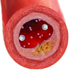 colesterol colesterol
