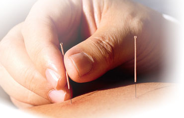 acupuntura acupuntura