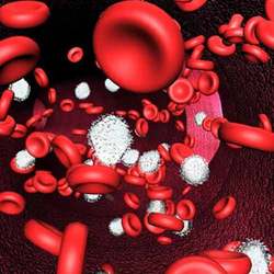 anemia anemia